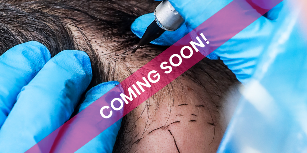 scalp pmu COOMING SOON scalp pmu COOMING SOON